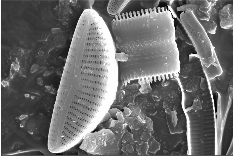 foto al microscopio elettronico di diatomee. Si possono notare in maniera più dettagliata le ornamentazioni presenti sul guscio siliceo dell’alga