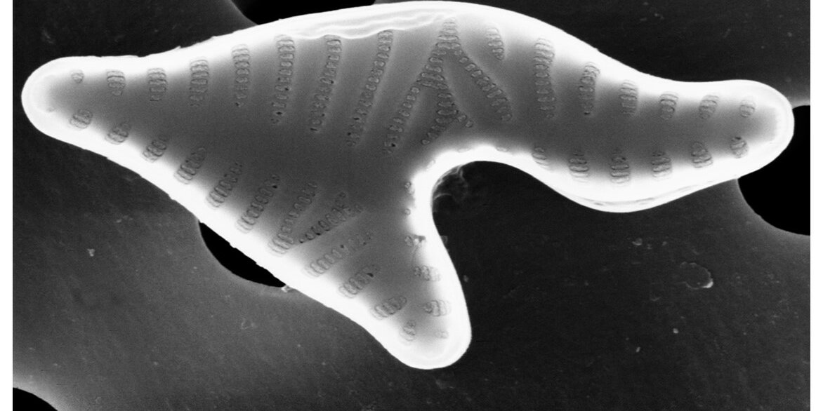 Foto di una diatomea nella sua forma teratologica eseguita tramite il microscopio elettronico a scansione. Si noti come la morfologia dell’alga risulta essere completamente deformata, rendendo difficile il riconoscimento anche a livello di genere