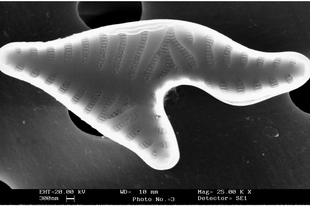 Foto di una diatomea nella sua forma teratologica eseguita tramite il microscopio elettronico a scansione. Si noti come la morfologia dell’alga risulta essere completamente deformata, rendendo difficile il riconoscimento anche a livello di genere