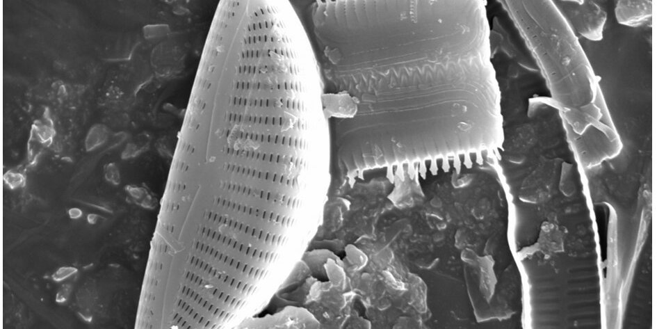 Electron microscope image of diatoms. The detailed ornamentations on the algae's siliceous shell are visible.