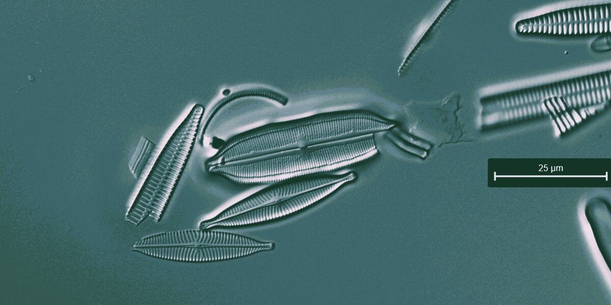 Foto al microscopio ottico di alcune diatomee bentoniche fluviali