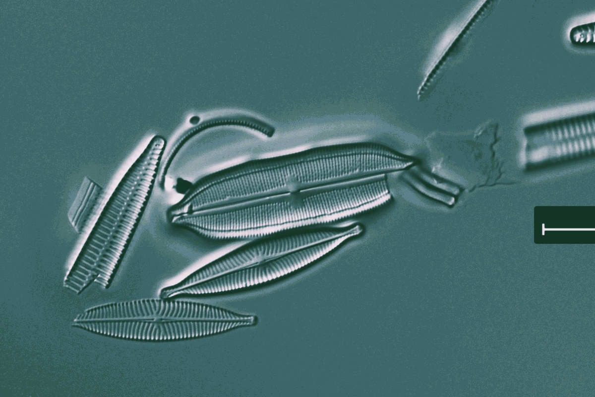 Foto al microscopio ottico di alcune diatomee bentoniche fluviali