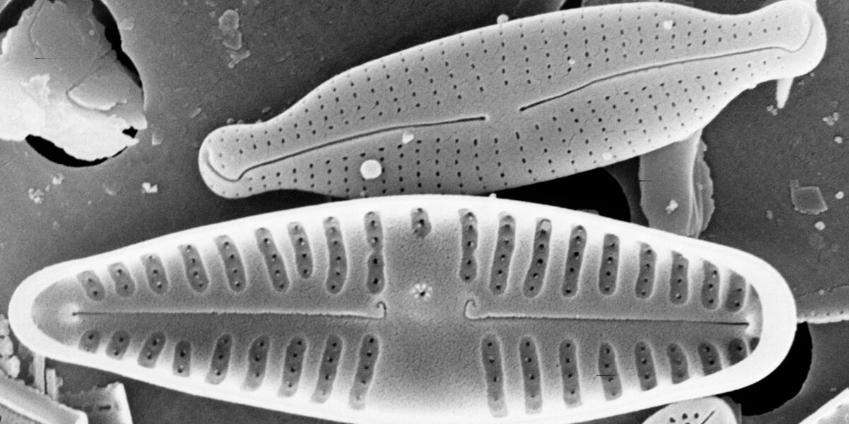 immagine al microscopio in bianco e nero: si vedono due organismi unicellulari in forte ingrandimento