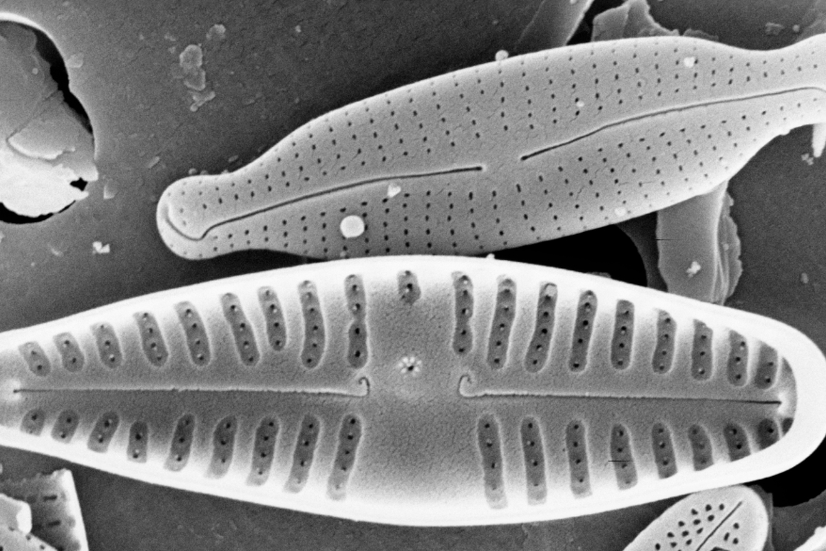 immagine al microscopio in bianco e nero: si vedono due organismi unicellulari in forte ingrandimento